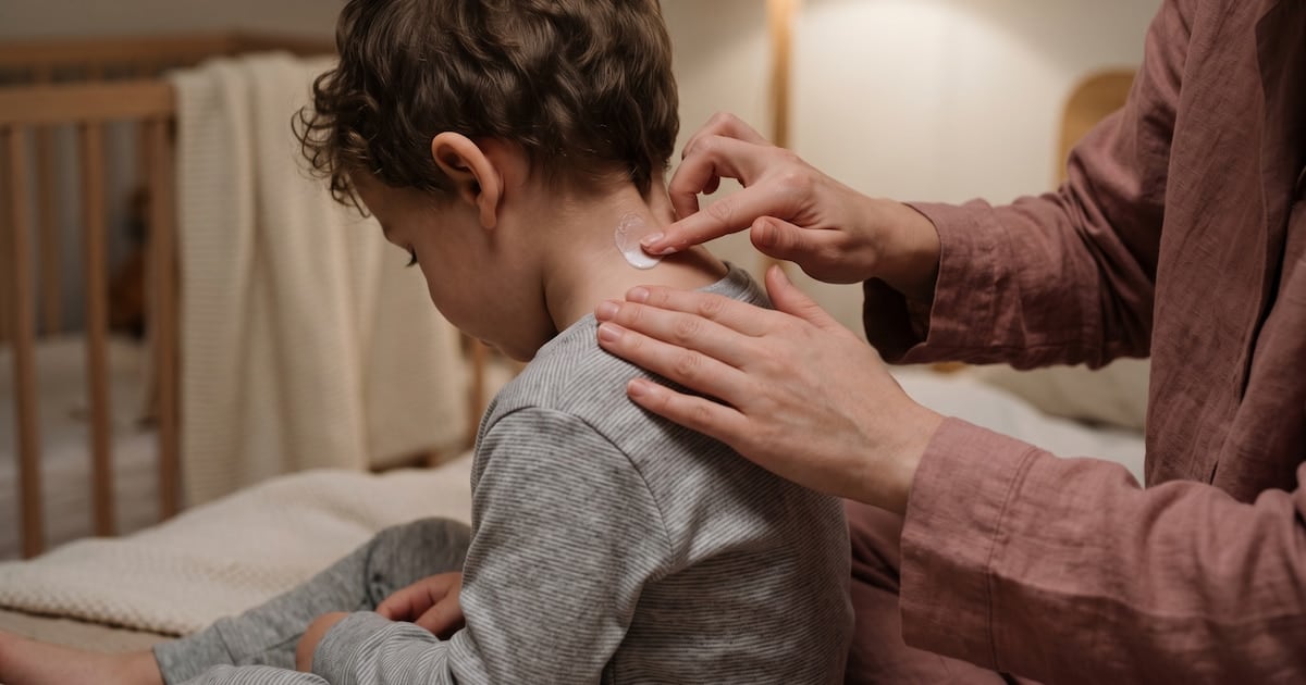 La dermatitis atópica no se va: por qué cuesta tanto sostener el tratamiento cuando la plata no alcanza