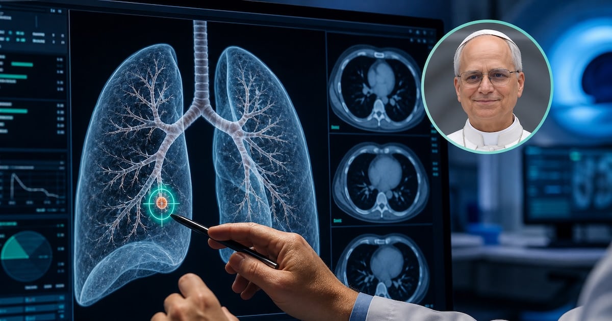El nódulo pulmonar de tres milímetros: por qué se opera una lesión tan chica y qué significa para el paciente